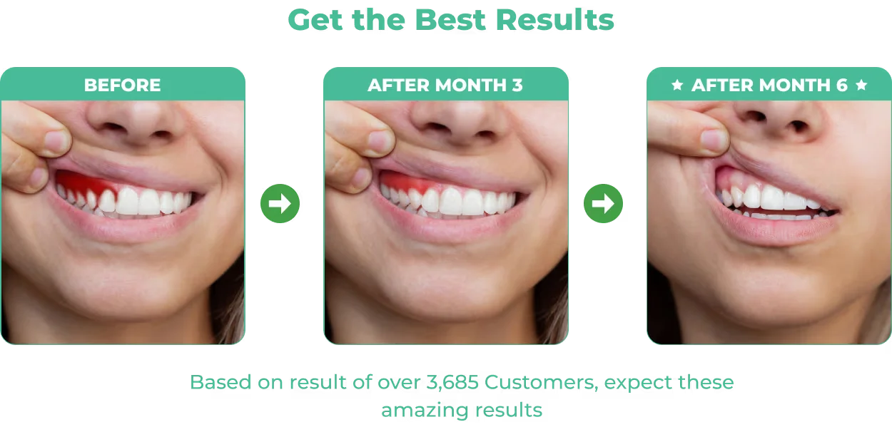 DentalPrime Advanced Oral Health Support